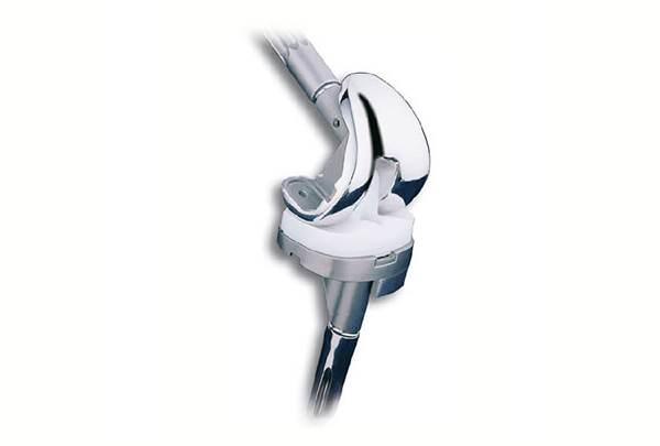 Knee Replacement